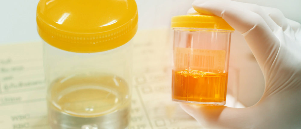 DOT Urine Specimen Collection Training DOT Urine Specimen Collection Training
